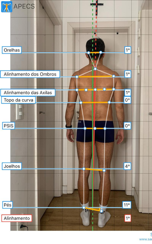 Análise postural lateral na Fisio Performa